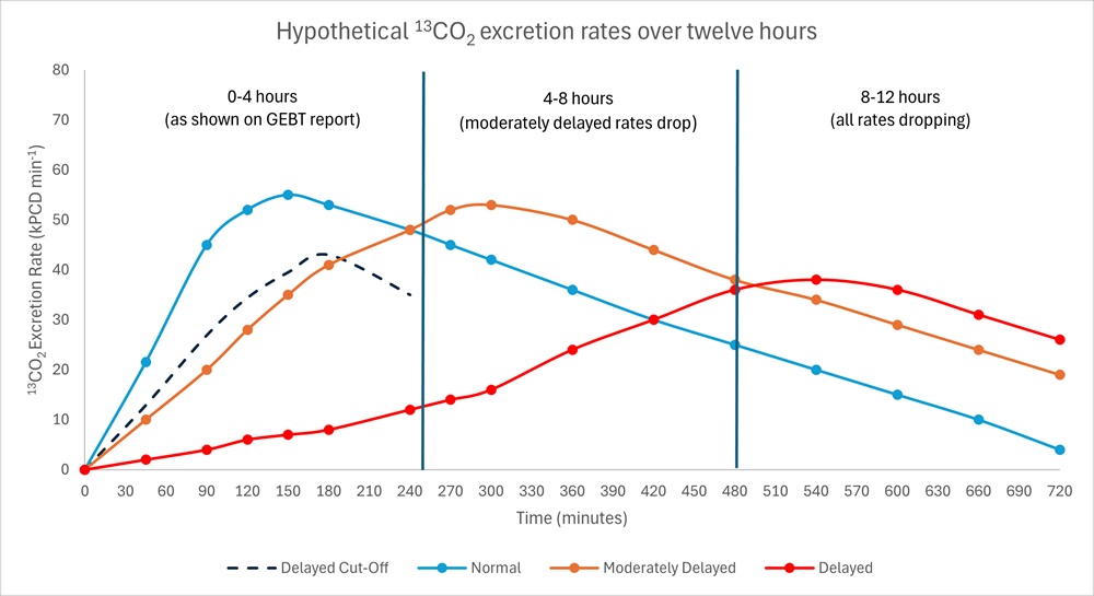 Shape of GEBT Curves in Sample Report by Cairn Diagnostics